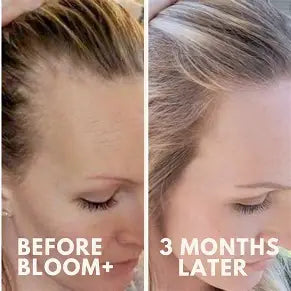 Bloom Hair Growth Elixir